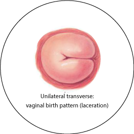 Cervix beautiful FAQ